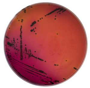 Isolement de Salmonella sur milieu XLD