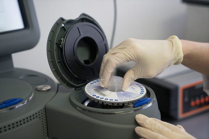 Peparation-echantillons-pour-analyses-rapides-par-PCR-quantitative